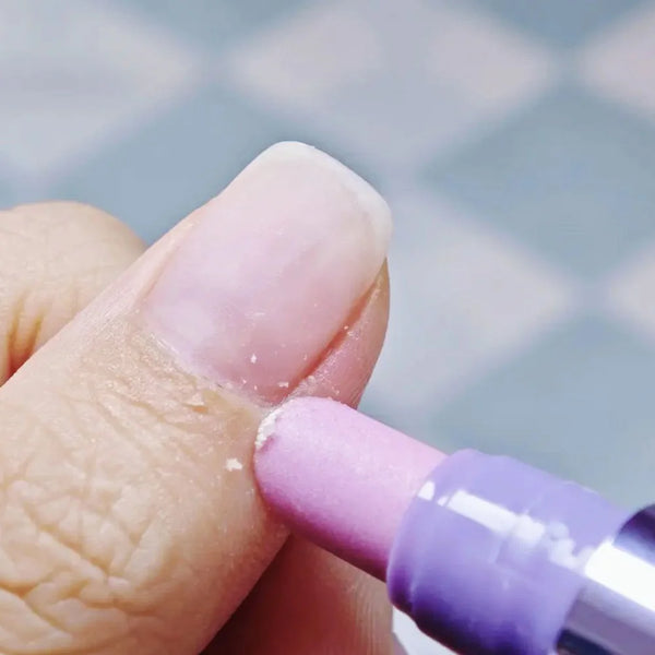 3-in-1 Cuticle Oil Pen with Ceramic Tip – Nail Repair, Dead Skin & Cuticle Remover for Nail Care