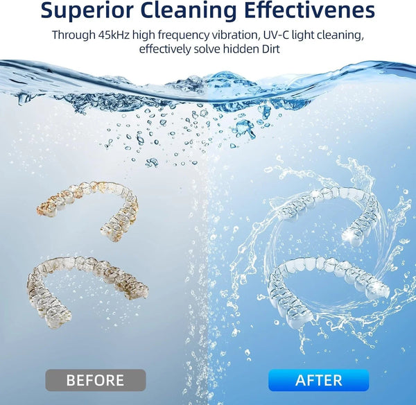 Ultrasonic Denture Cleaner – 45kHz Portable Retainer & Orthodontic Cleaning Machine