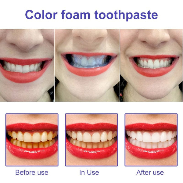 SearchFindOrder Advanced Dental Cleanser for Bright Smiles