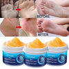 SearchFindOrder Moisturizing Dead Skin Removal Skin Cream