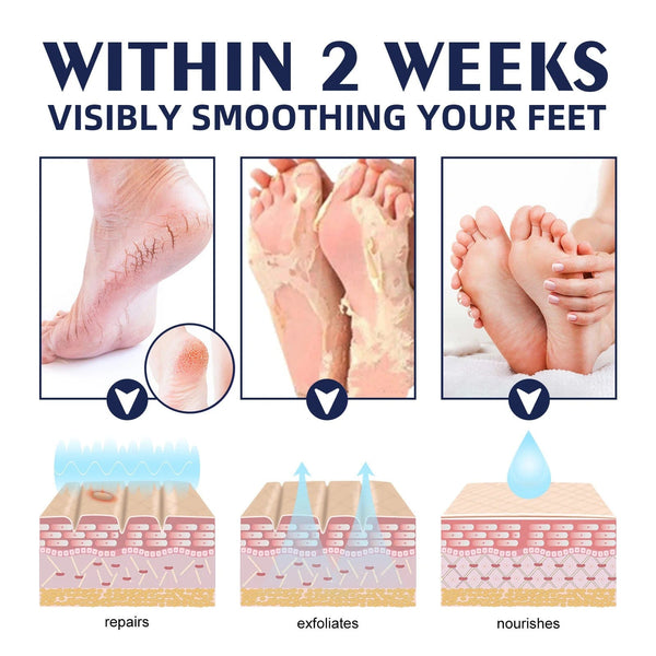 SearchFindOrder Moisturizing Dead Skin Removal Skin Cream