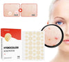 SearchFindOrder Skin Clear Pro 144-Piece Acne Pimple Patch Set for Invisible Healing and Spot Coverage