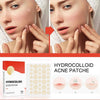 SearchFindOrder Skin Clear Pro 144-Piece Acne Pimple Patch Set for Invisible Healing and Spot Coverage