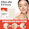 SearchFindOrder Skin Clear Pro 144-Piece Acne Pimple Patch Set for Invisible Healing and Spot Coverage