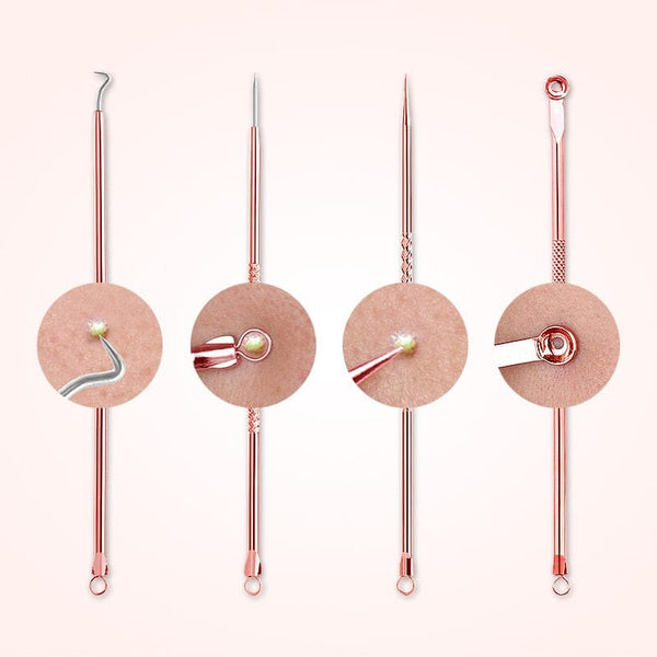 SearchFindOrder 4pcs Acne Blackhead Removal Needles Black Dots Acne Remover Squeeze Deep Cleansing Facial Blackhead Eliminators Skin Care Tools
