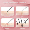 SearchFindOrder Ultra-fine No.5 Blackhead Removal Tweezers