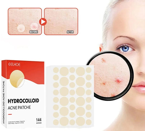 SearchFindOrder Skin Clear Pro 144-Piece Acne Pimple Patch Set for Invisible Healing and Spot Coverage