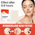 SearchFindOrder Skin Clear Pro 144-Piece Acne Pimple Patch Set for Invisible Healing and Spot Coverage