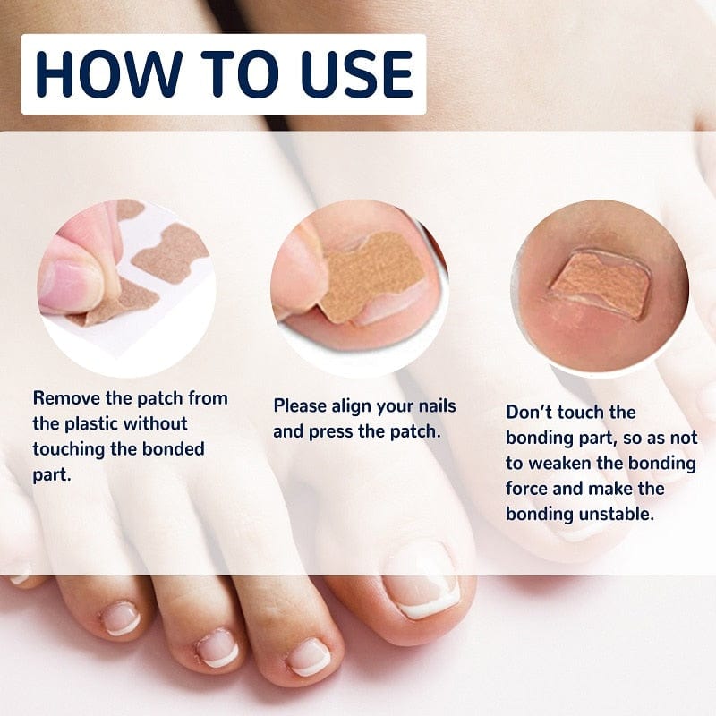 Toenail Paronychia Relief Patches (50 pcs) – SearchFindOrder