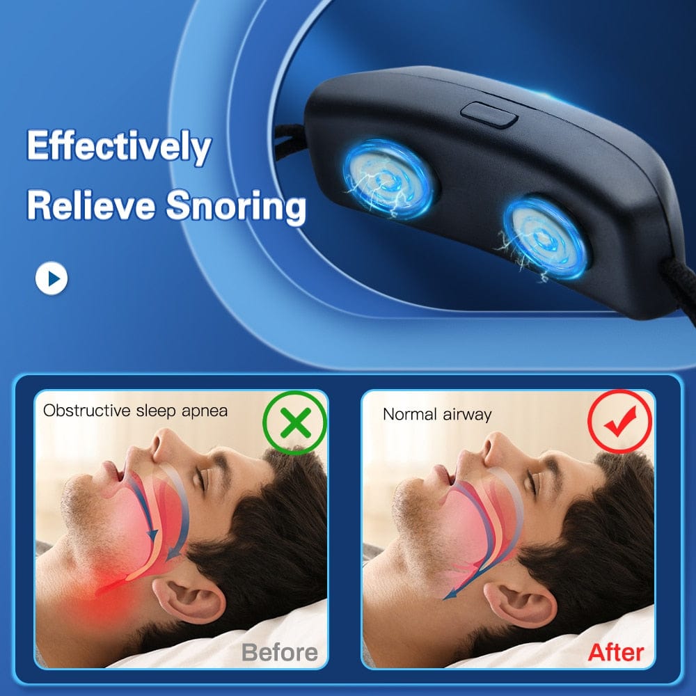 Snore Less Device Smart Anti-Snoring Sleep Apnea Relief EMS Device – SearchFindOrder