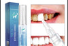 SearchFindOrder Whitening Dental Gel Pen