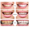 SearchFindOrder Whitening Dental Gel Pen