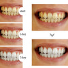 SearchFindOrder Whitening Dental Gel Pen